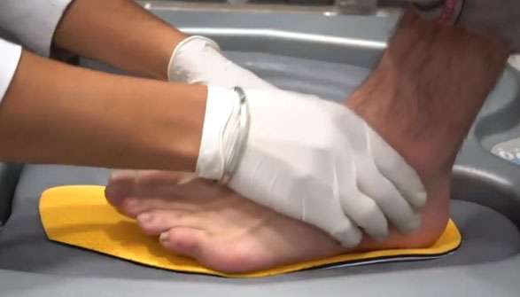 thermoforming insoles