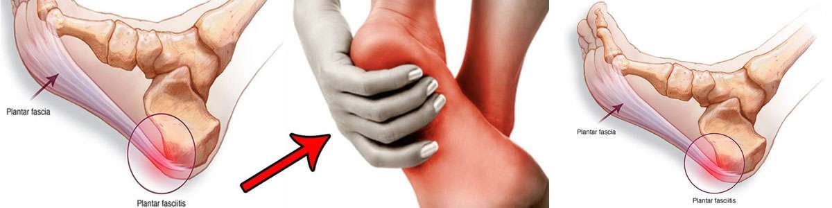 Causes & Treatment of Pain on Top of My Foot Near the AnkleAdvent Physical  Therapy