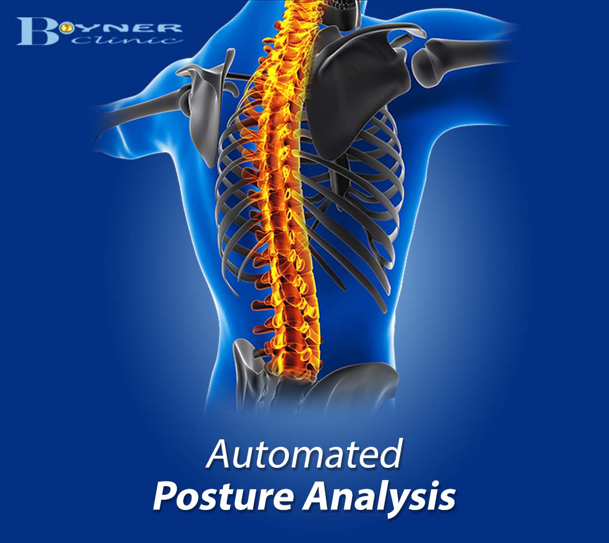Automated Posture Analysis