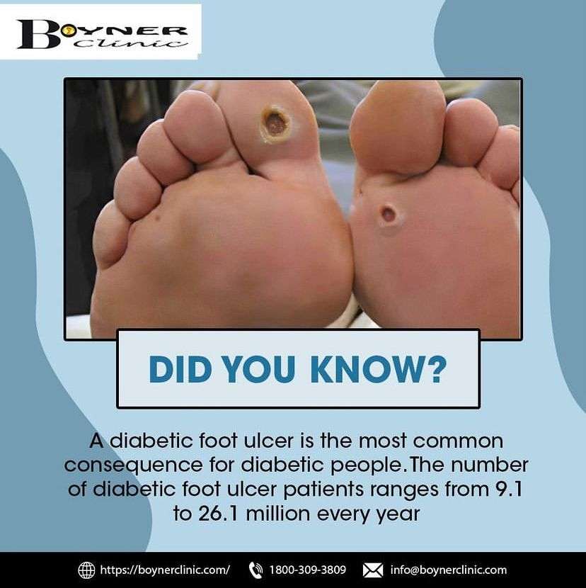 Diabetic Insoles