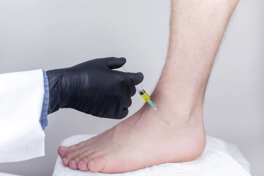 Achilles Tendon Injuries